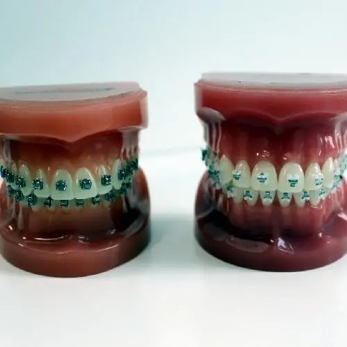 brackets baender boegen