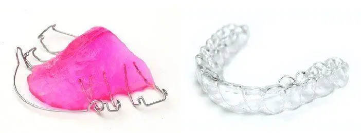 retainers